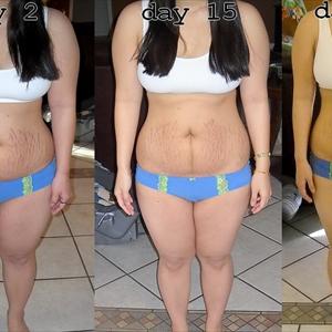 Loss Product Weight - Getslim Posts Information About Following The Correct Diet Plan After Surgery